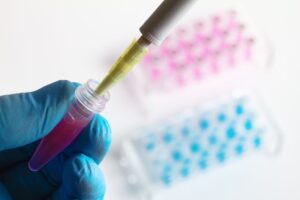 Πλήρης νουκλεοτιδική αλληλούχιση του γονιδίου της Κυστικής Ινωσης (CFTR) με Next Generation Sequencing